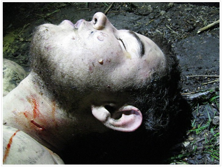 Close up of 19 y.o. Kyiv University student Yuriy Popravko face. Traces of sadistic torture and killing on face and neck.